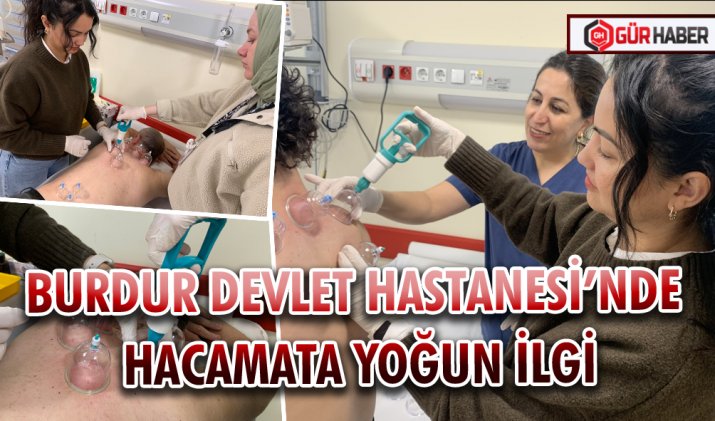 BURDUR DEVLET HASTANESİ’NDE HACAMATA YOĞUN İLGİ