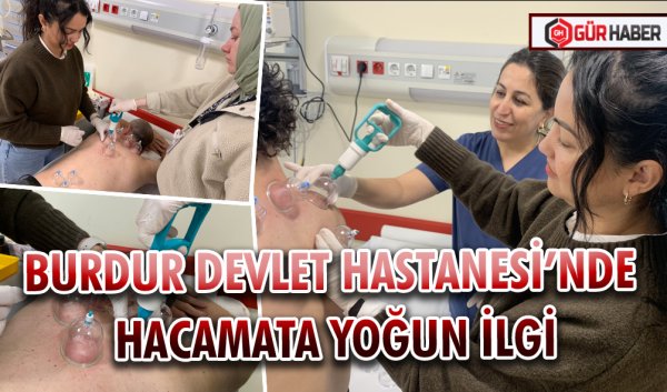 BURDUR DEVLET HASTANESİ’NDE HACAMATA YOĞUN İLGİ